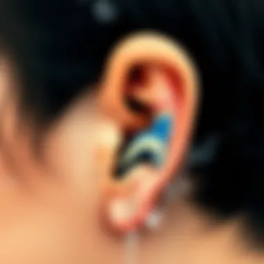 Anatomy of the Ear Diagram illustrating the anatomy of the ear