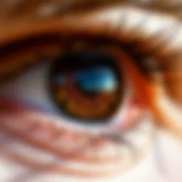 Illustration of pterygium on the eye